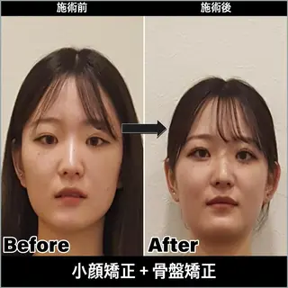 顔と身体の歪み改善 リファイン国分寺店のエステ・リラクイメージ