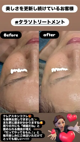 LiZA エステティックサロンのエステ・リラクイメージ