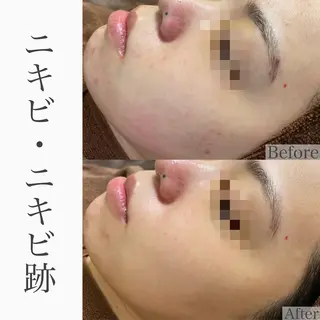 ハーブピーリング専門 BIOEL横浜のエステ・リラクイメージ