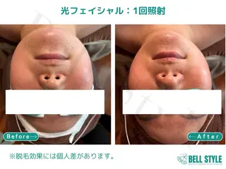 メンズ メンズ&レディース　Bell style所属・【脱毛・美肌専門】 bellstyleのエステ・リラクイメージ