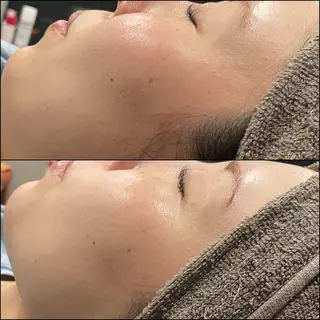 LiZA エステティックサロンのエステ・リラクイメージ