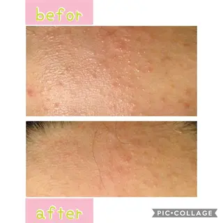 癒し腸もみサロン シャユーム　ゆきなのエステ・リラクイメージ