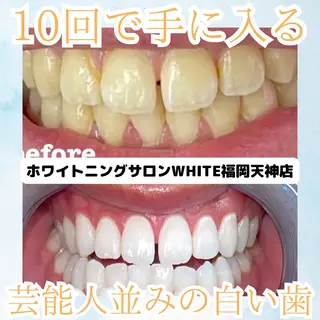メンズ ホワイトニング専門店 WHITE天神店のエステ・リラクイメージ