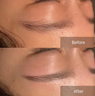 アイブロウ for woman所属・森 美優のエステ・リラクイメージ