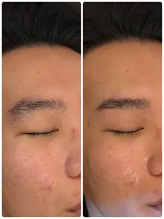 メンズ アイブロウ メンズガーデン今池店所属・メンズガーデン 今池の眉毛・アイブロウイメージ