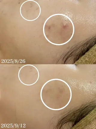 WHITE AQUA 北千住店のエステ・リラクイメージ