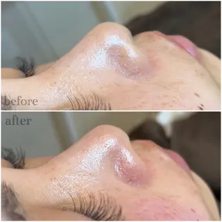 meili beautyのエステ・リラクイメージ