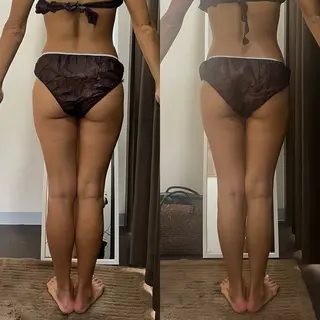 ハイパーナイフ専門店 Salon de COCO所属・Salon de COCOのエステ・リラクイメージ