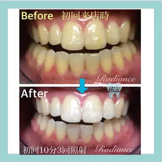 札幌ホワイトニング ラディアンス札幌駅店のその他イメージ