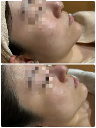 脱毛&フェイシャル 専門店muro.のエステ・リラクイメージ