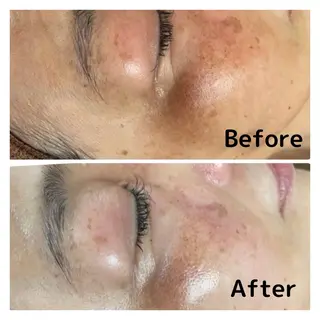 NiU.BEAUTY 新宿のエステ・リラクイメージ