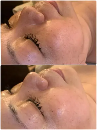 esty hitomiのエステ・リラクイメージ