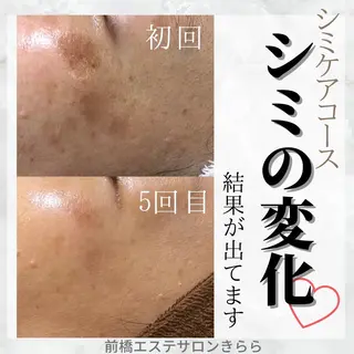 前橋エステサロンきらら所属・エステサロンきらら 瀧澤のエステ・リラクイメージ