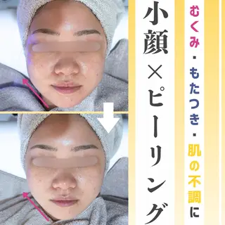 s o i n a🤍🪽ララピール／毛穴／小顔／水光肌所属・s o i n a 神楽坂のエステ・リラクイメージ