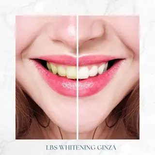 ミディアム メンズ カラー LBSホワイトニング 銀座店💎公式のその他イメージ