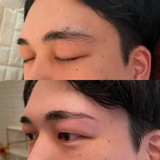 メンズ アイブロウ 毛穴ケア/毛穴診断/ 毛穴洗浄〔心斎橋〕のエステ・リラクイメージ