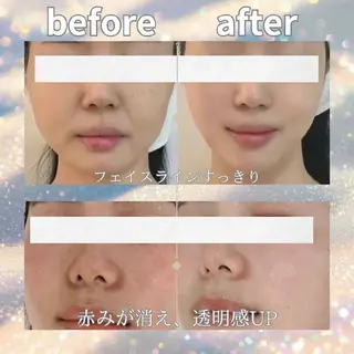 アイブロウ aliaハイフ&水光ジェットサロン所属・aliaハーブ水光店 エステティシャン募集のエステ・リラクイメージ