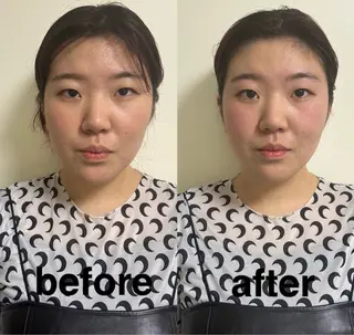 美容鍼灸サロン mahoroba院長のエステ・リラクイメージ