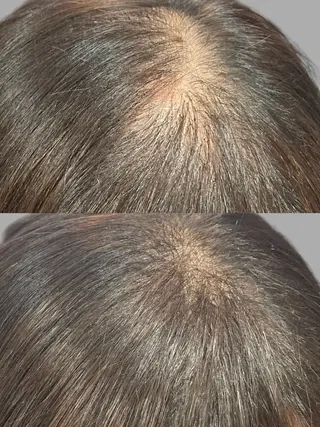 25ニコ所属・25 ニコのヘアスタイル