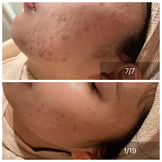 CHERIE所属・CHERIE Hisadaのエステ・リラクイメージ