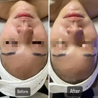 脱毛＆Beauty salon IILA所属・肌管理/HBL専門店 Sakuraの眉毛・アイブロウイメージ