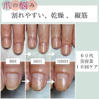 ネイル AKT NAIL所属・AKT Beauty ドライヘッドスパのネイルデザイン