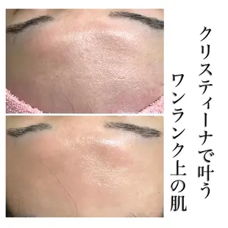 エステ矢野 ジョアアンジェ心斎橋のエステ・リラクイメージ