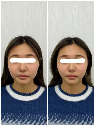 美容鍼×小顔矯正 ×美容整体 浜川泰仁のエステ・リラクイメージ