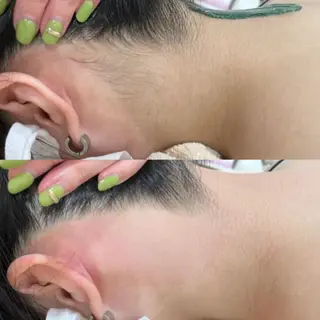 フェイシャル/脱毛 ジョアアンジェ さきのエステ・リラクイメージ