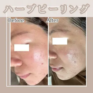 メンズ キッズ Amaryllis 🌹松本のエステ・リラクイメージ