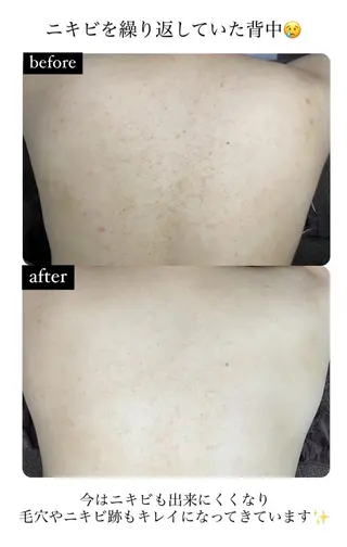 ベラージュ【美背中・ 美尻・フェイシャル】のエステ・リラクイメージ