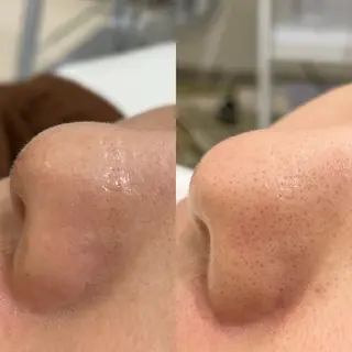 SALON DE BELLECOA所属・RINA ♡のエステ・リラクイメージ