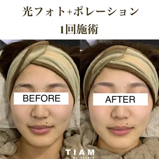 美肌サロンTIAM by tetoteのエステ・リラクイメージ