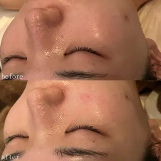 デ・アイム心斎橋所属・肌質改善サロン🫧 MAIのエステ・リラクイメージ