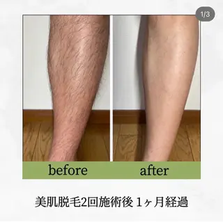Micell beauty所属・Micell beautyのエステ・リラクイメージ