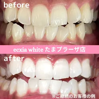 セルフホワイトニング　エクシアたまプラーザ店所属・セルフホワイトニング エクシアたまプラーザのその他イメージ