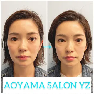 小顔美容鍼専門サロン 渋谷YZのエステ・リラクイメージ