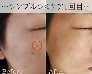 シミたるみケア リラク リタ池尻大橋のエステ・リラクイメージ