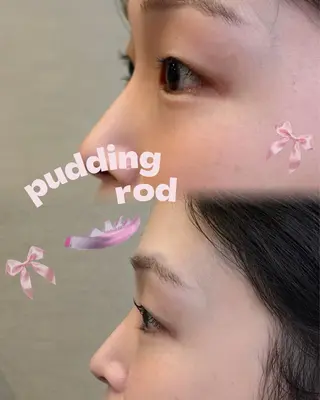 マツエク・マツパ Le'a first AKANEのマツエク・マツパデザイン