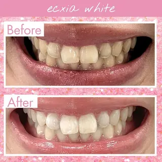 セルフホワイトニング エクシア福島のその他イメージ