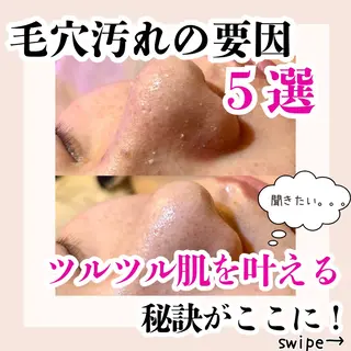 毛穴洗浄専門サロン/CareNa梅田【毛穴/ケアナ】所属・CareNa梅田店 🌿住田摩利弥のエステ・リラクイメージ
