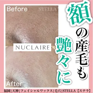 ドライヘッドスパ＆ リンパ専門店　ステラのエステ・リラクイメージ