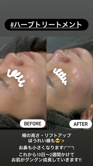 LiZA エステティックサロンのエステ・リラクイメージ