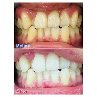 MBEAUTYSALON 千葉店・京成大久保所属・Melty 輝のその他イメージ