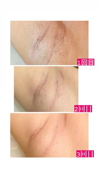 脱毛・エステサロン LuLuNのエステ・リラクイメージ