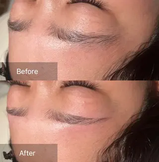 アイブロウ for woman所属・森 美優のエステ・リラクイメージ