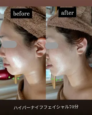 km retreat mentのエステ・リラクイメージ