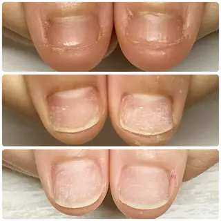ネイル BellaLuna 金子のネイルデザイン