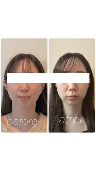 小顔と ヘッドスパのお店のエステ・リラクイメージ