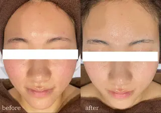 DahliaBeauty ダリアビューティー所属・DahliaBeau tyフェイシャル中村のその他イメージ